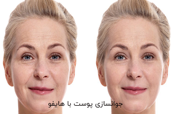 راه های جوانسازی پوست